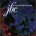 jbc