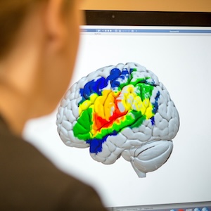 Multicolored brain scan on computer screen over shoulder of researcher